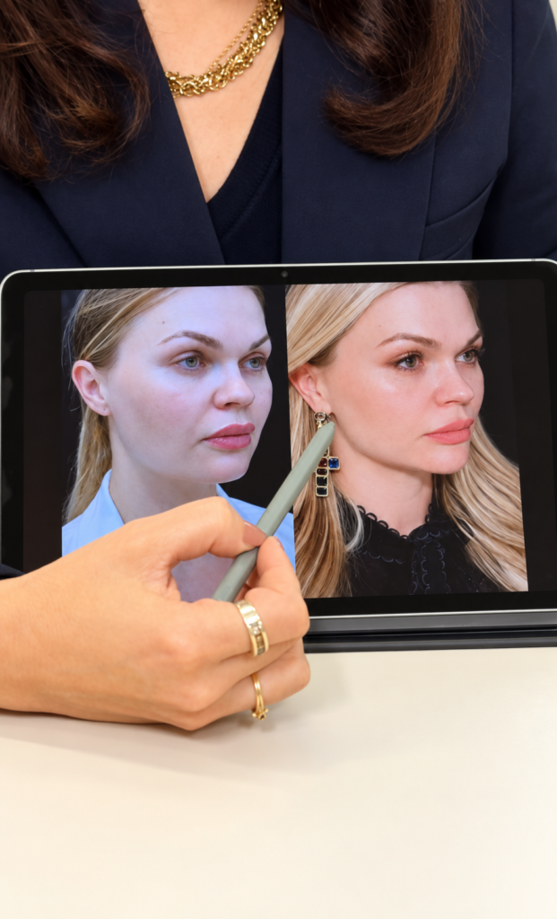 Dra. Lenir Dal Ben explicando um planejamento facial em um tablet